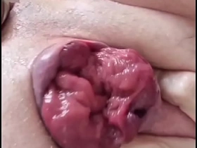 fart